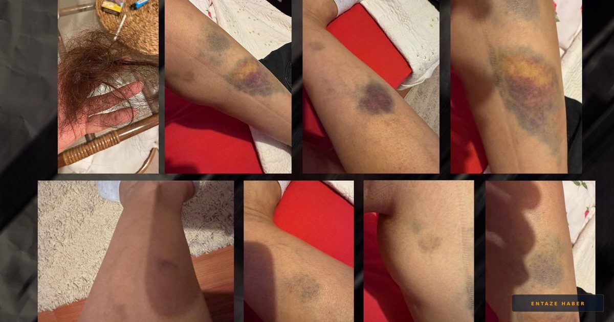 AKP'de Şiddet Skandalı: Sevgilisini Darp Eden MKYK Üyesi İstifa Ettirildi